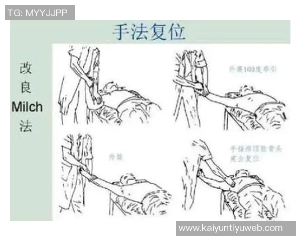 诺伊尔因手指关节囊受伤佩戴特制四指手套积极恢复状态